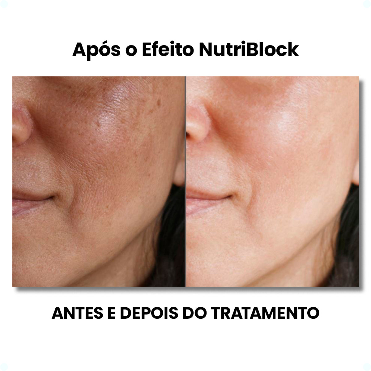 Protetor Solar Oral Nutriblock Anti-melasma - Protetor Solar Oral - 100% Natural Medical Pro 30 caps